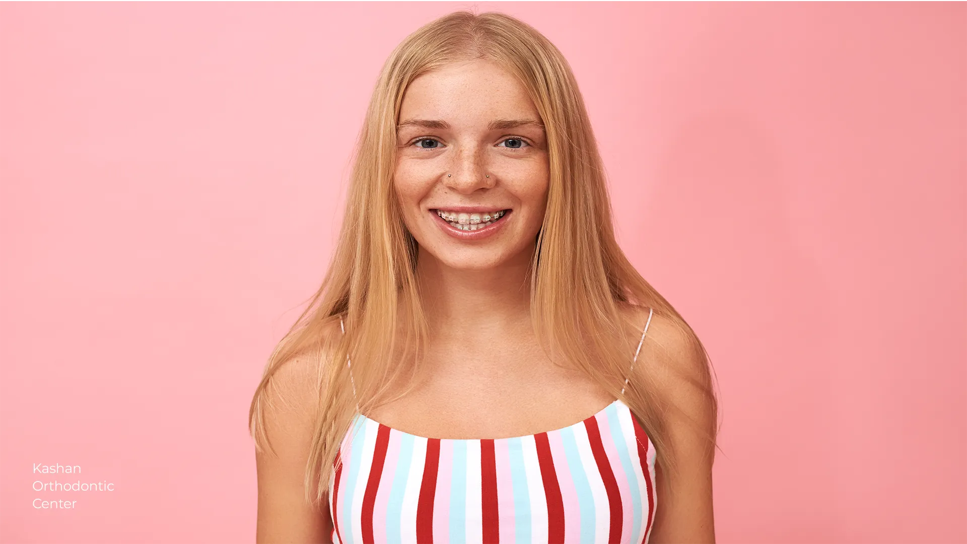 ارتودنسی در کاشان با جدیدترین روشها؛ فرصت طلایی برای داشتن لبخند ایدهآل 51 لبخند زیبا و سالم پس از ارتودنسی در کاشان